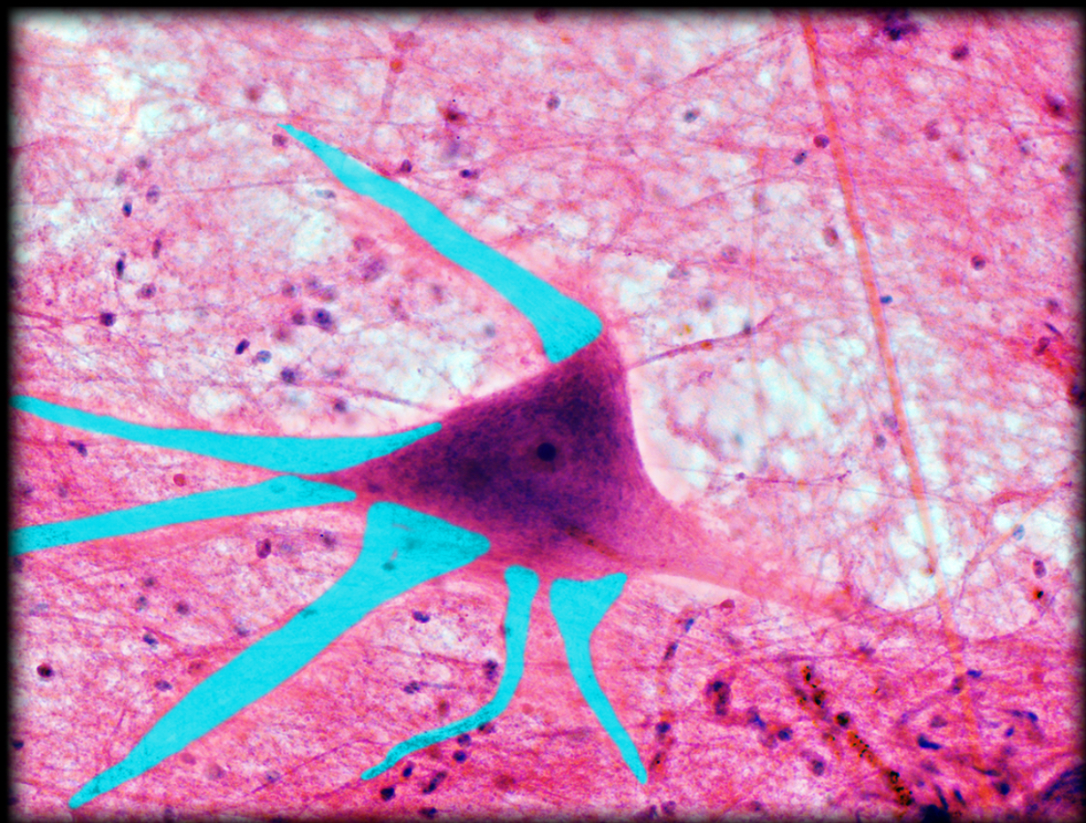 <h4 collapsed="false" seolevelmigrated="true"><strong>Location:</strong></h4><ul><li><p>Central nervous system</p></li><li><p>Ganglia of autonomic nervous system</p></li></ul><h4 collapsed="false" seolevelmigrated="true"><strong>Description:</strong></h4><ul><li><p>Tapered, highly branched processes extending from soma (cell body) of neuron</p></li><li><p>May have specialized sensory receptor (e.g., pressure receptor in hypodermis)</p></li></ul><h4 collapsed="false" seolevelmigrated="true"><strong>Function:</strong></h4><ul><li><p>Convey afferent nerve impulses (i.e., towards soma)</p></li><li><p>Receive information from other neurons</p></li></ul><h4 collapsed="false" seolevelmigrated="true"><strong>Comment:</strong></h4><ul><li><p>Not myelinated</p></li></ul>