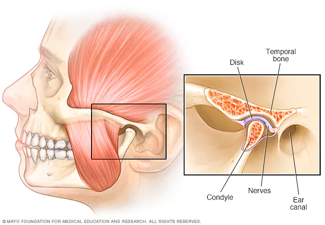 the point where the upper skull forms a joint with the lower jaw that is inferior to the zygomatic arch, and just anterior to the ear
