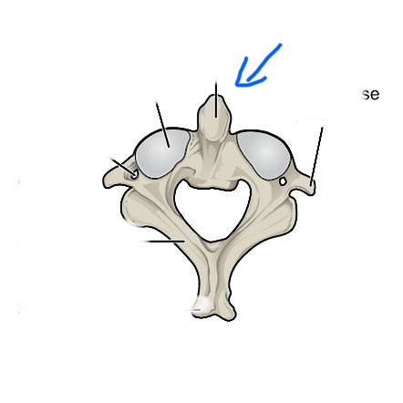 <p><span style="color: rgb(238, 240, 255)"><strong>a peg-like bony structure that projects from the second cervical vertebra (C2, or axis) and serves as the pivot point for head rotation</strong></span></p>
