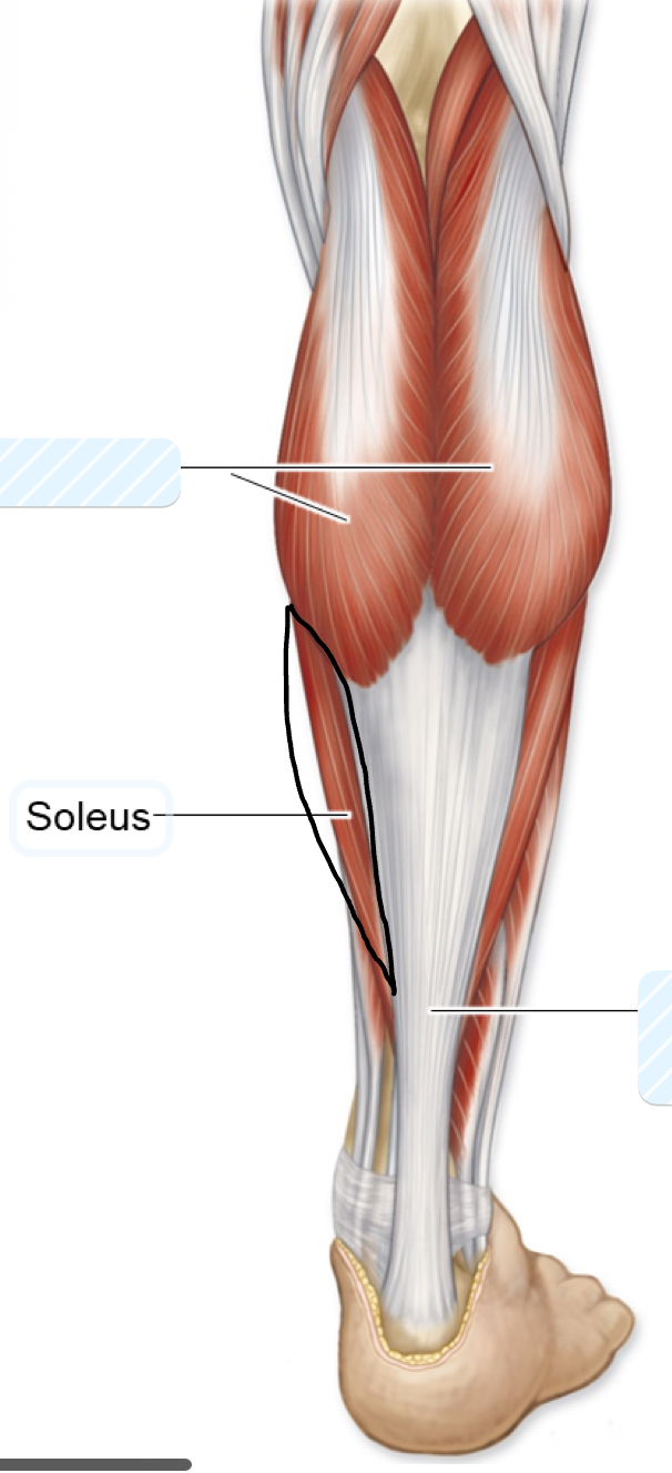 <p>soleus</p>