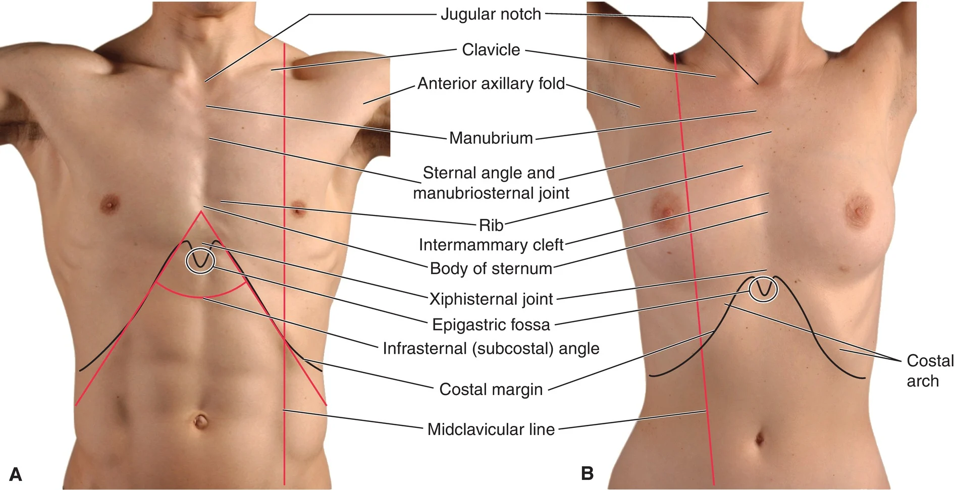 <ul><li><p>clavicles</p></li><li><p>manubrium (<em>sternal angle at 2nd rib=angle of louis</em>)</p></li><li><p>sternum, 12 pairs of ribs, 12 vertebra posteriorly</p></li><li><p><span>costal margin</span>=inferior rib border</p></li></ul><p></p>