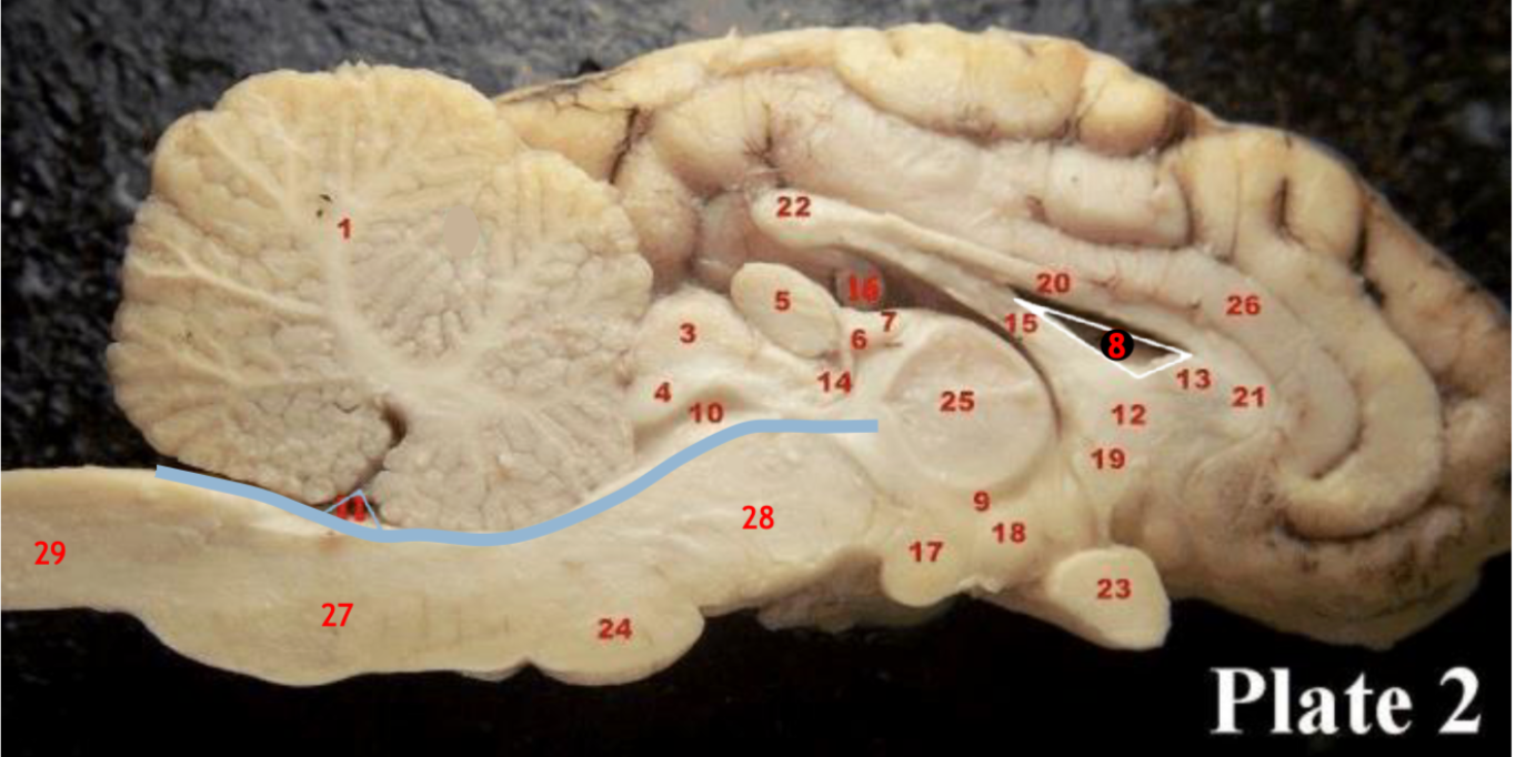 <p><span>Optic chiasm</span></p>