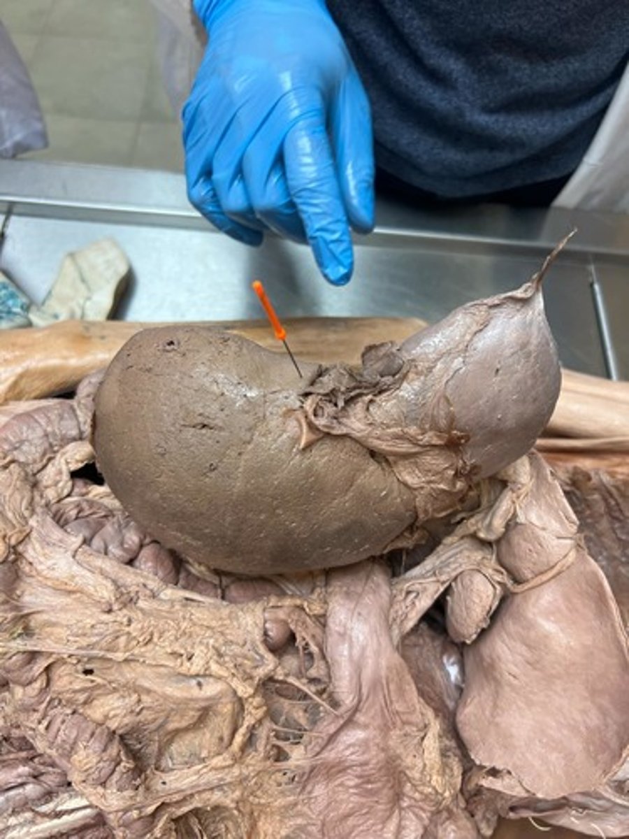 <p>bare area of liver</p>