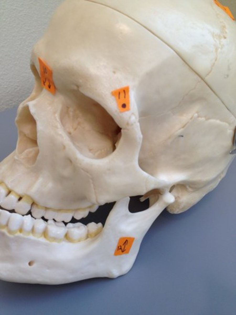 <p>articulates with frontal bone</p>