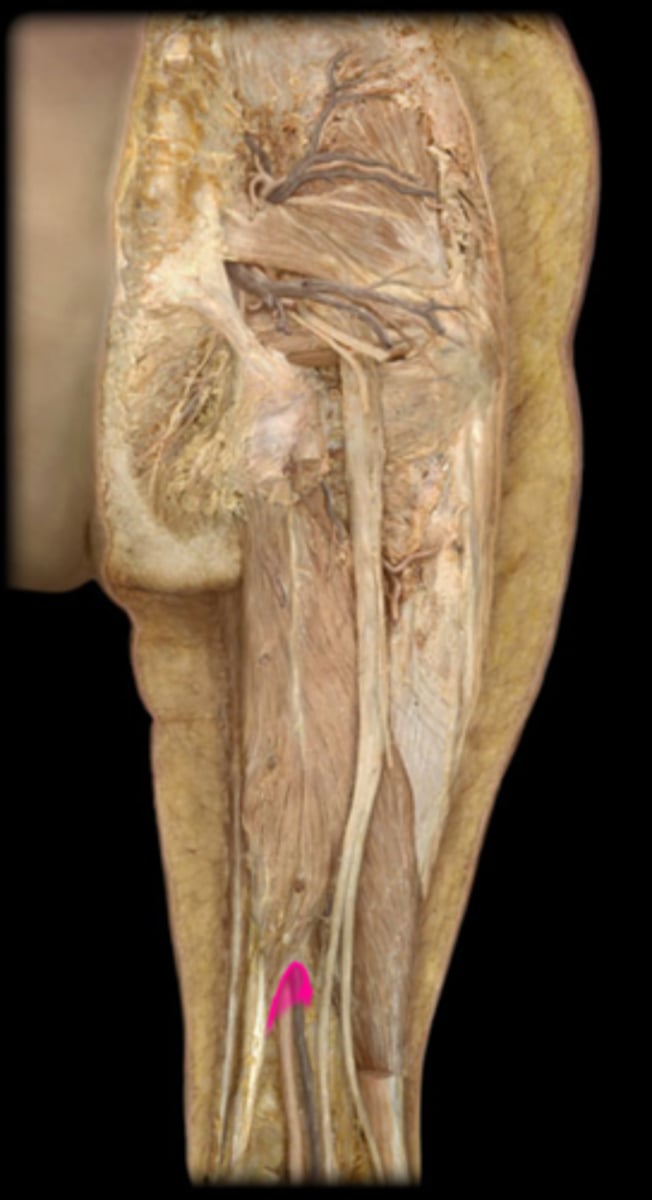 <p>What is the name of this gap that allows for the passage of the femoral vessels from the anterior thigh to the posterior thigh?</p>