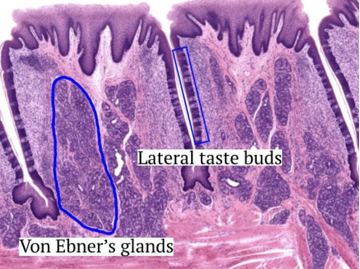<ul><li><p>Las menos desarrolladas en humanos</p></li><li><p>Forma cuadrada</p></li><li><p>Papilas gustativas laterales</p></li><li><p>Glándulas de Von Ebner (secretan líquido para limpiar los surcos y mejorar la percepción del sabor)</p></li><li><p>Ubicadas en la superficie lateral de la lengua</p></li><li><p>Numerosas dispuestas en filas paralelas</p></li><li><p><span style="color: red">No queratinizado</span></p></li></ul><p></p><p>(Son más funcionales en bebés y niños, pero en adultos pierden muchas de sus células gustativas)</p>