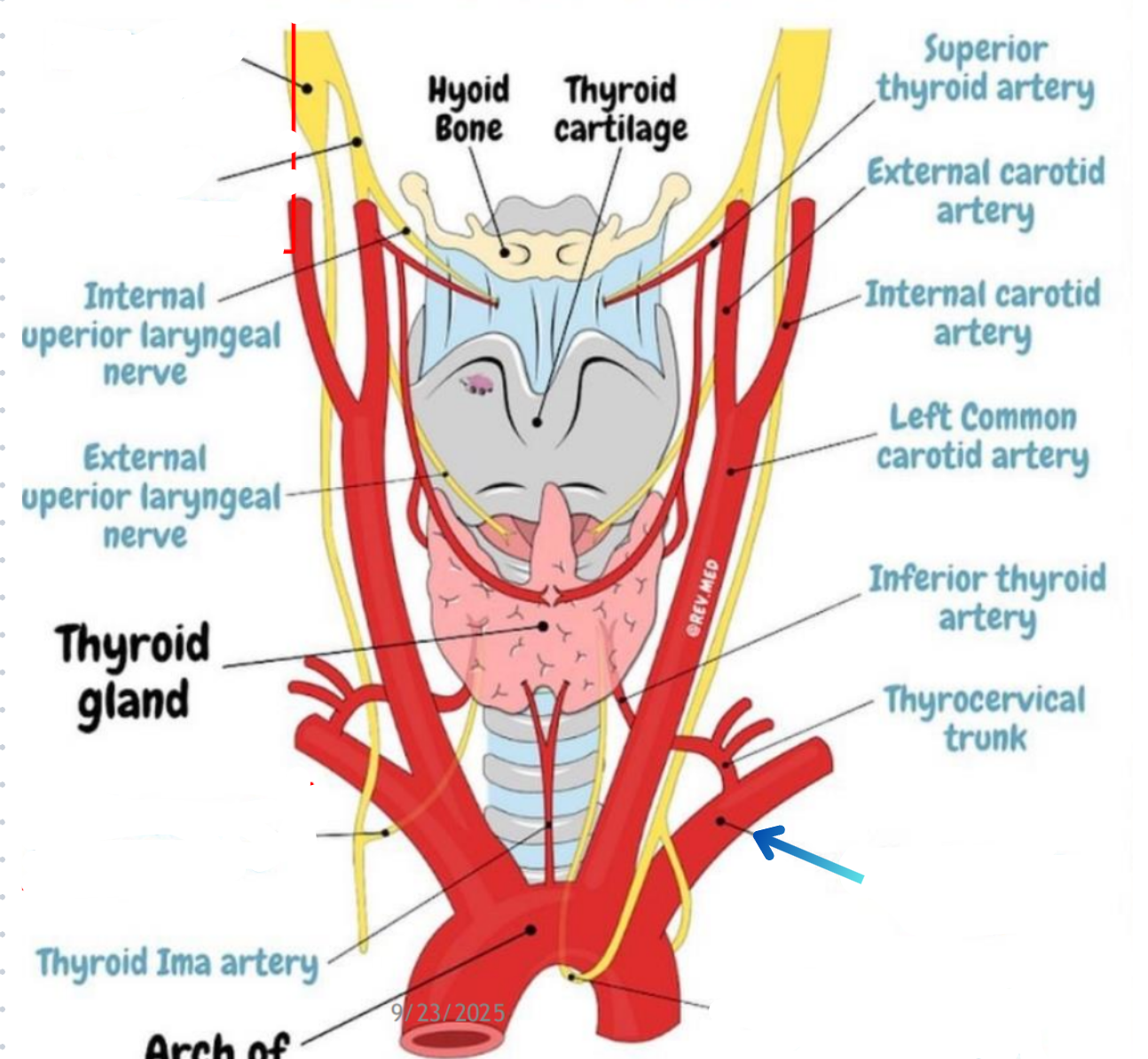 term image