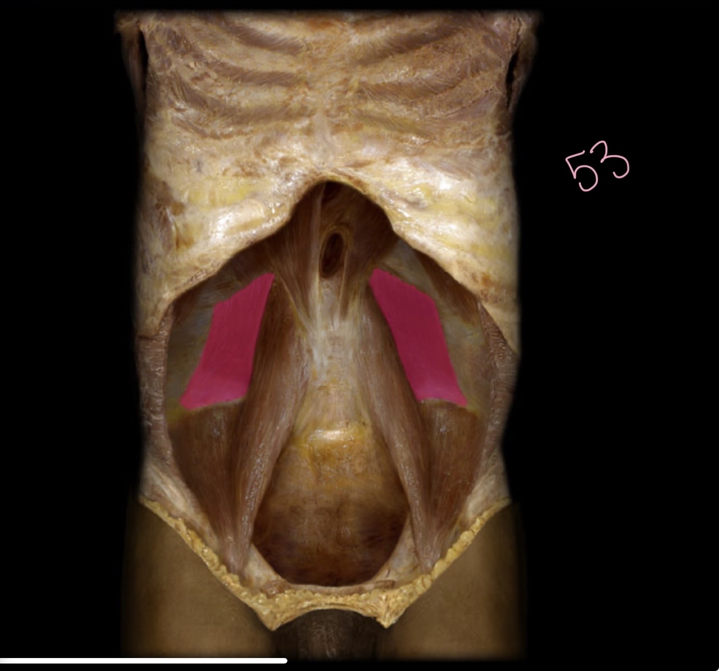 <p>Quadratus lumborum</p>