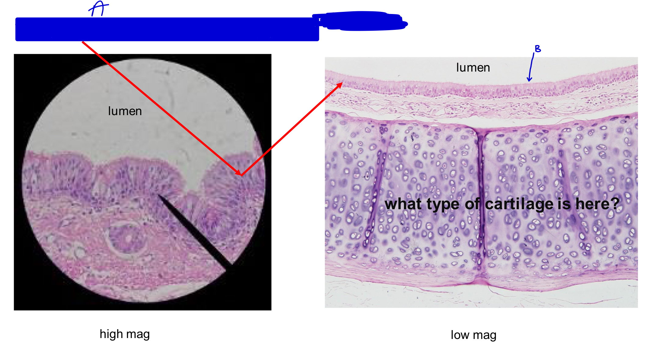 <p>what type of cartilage is here?</p>