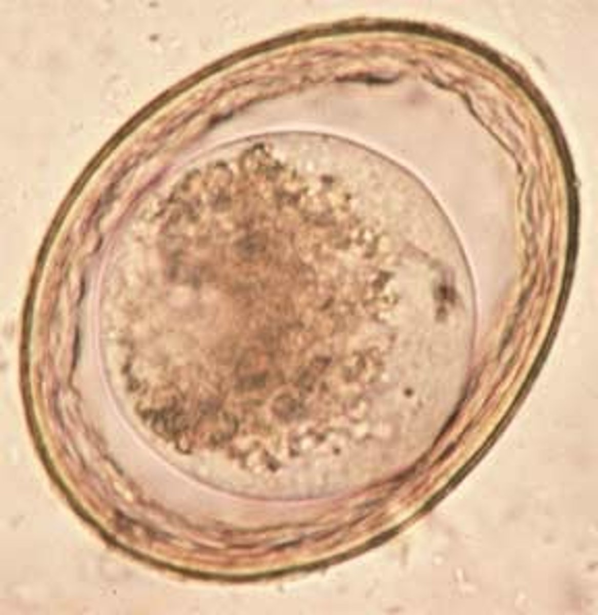 <p>feline and canine roundworm</p>