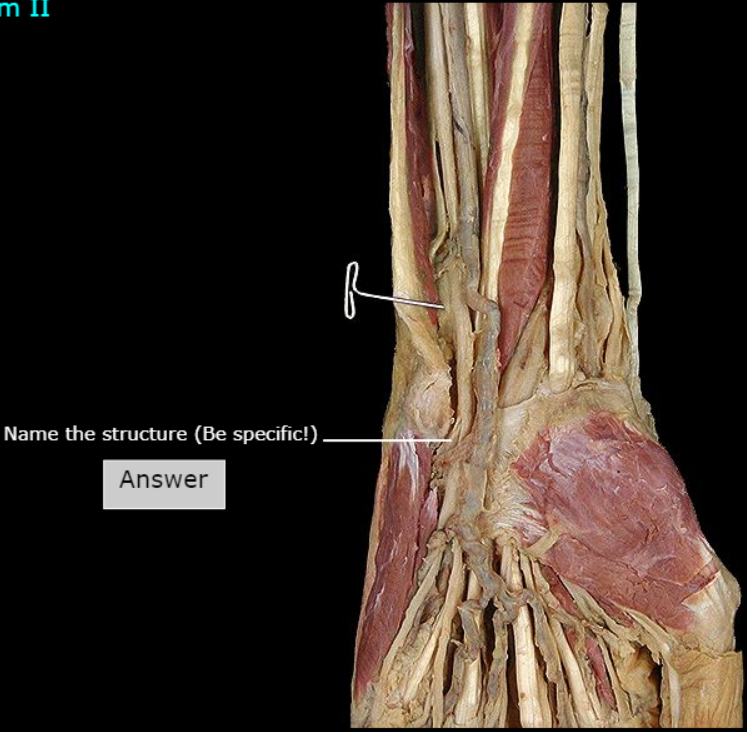 <p>What nerve is this</p>