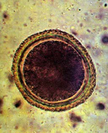 <p>Toxocara canis, Toxocara cati, Toxascaris leonina</p>