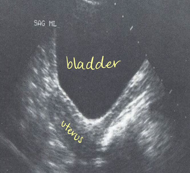 <p>what is this image showing?</p>