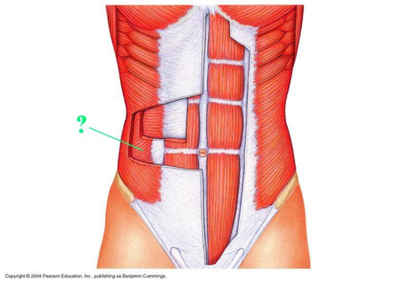 <p>Idenitfy the indicated muscle</p>