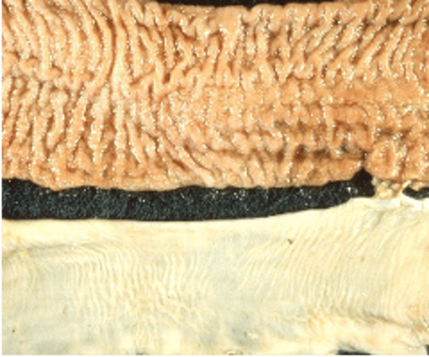 <p>how would you describe the appearance of this intestine</p>