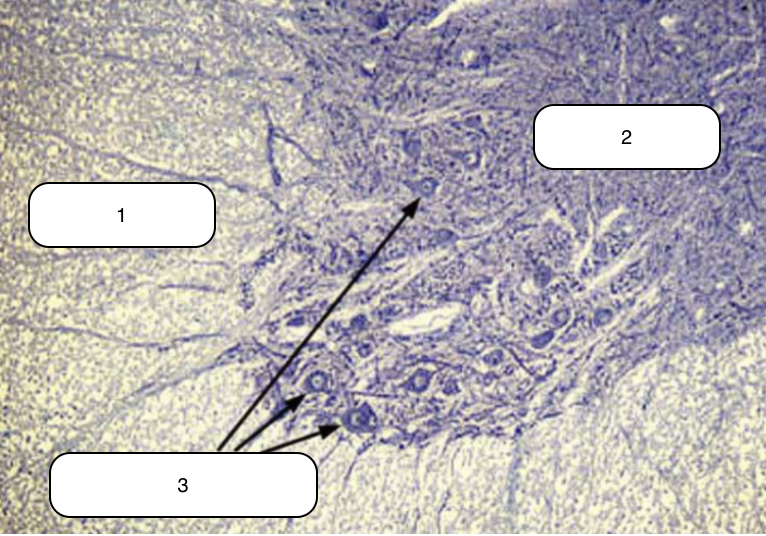 <p>Identify the structure labeled #1</p>