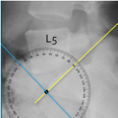 <p>Q what is the name of this measurement? and what is the average + range?</p>