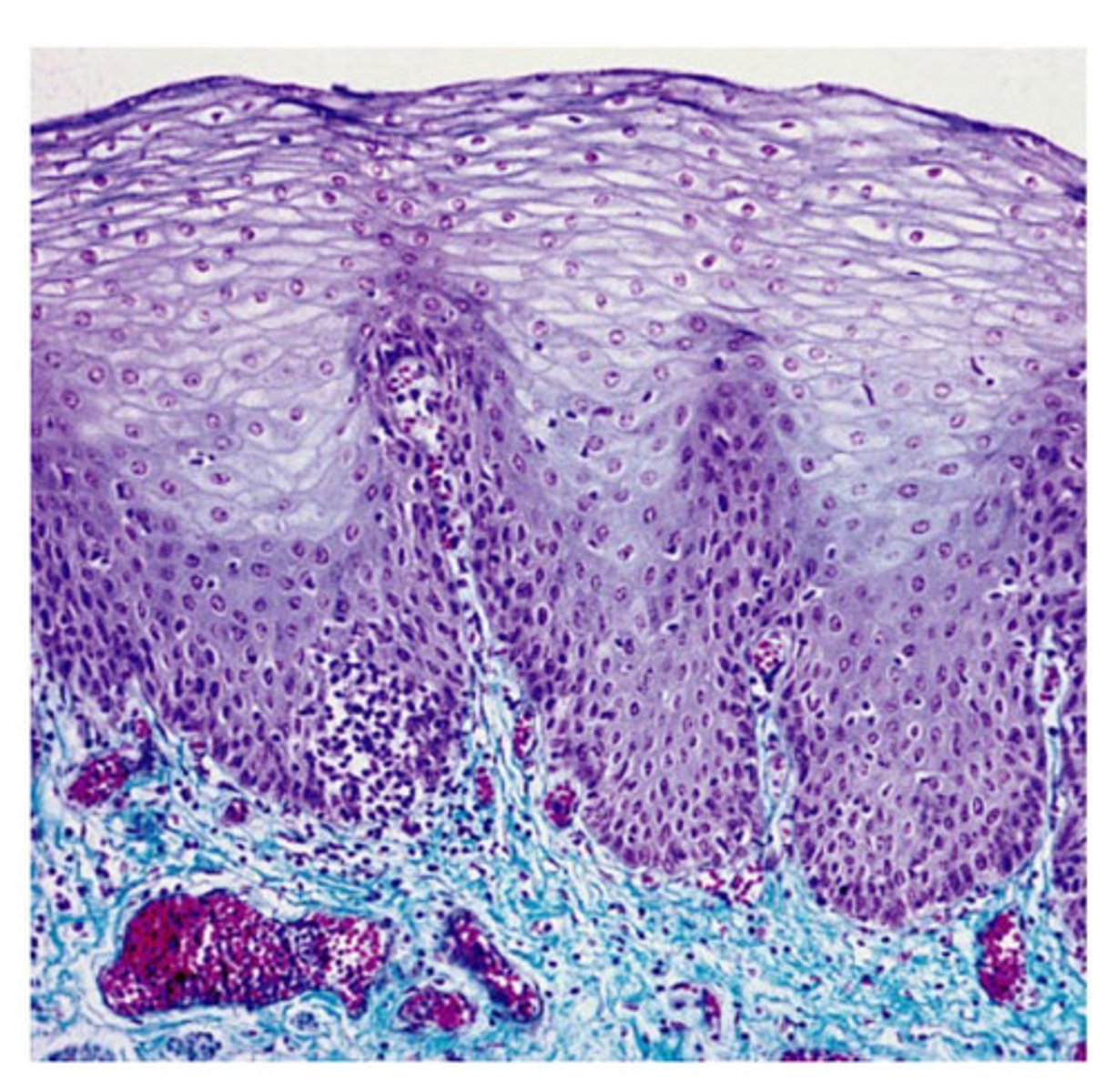 <p>Stratified squamous epithelium</p>