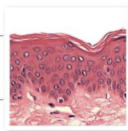 <ul><li><p>protective epithelia have many stacked layers of cells that are constantly being replaced</p></li><li><p>example: layers in skin</p></li></ul><p></p>
