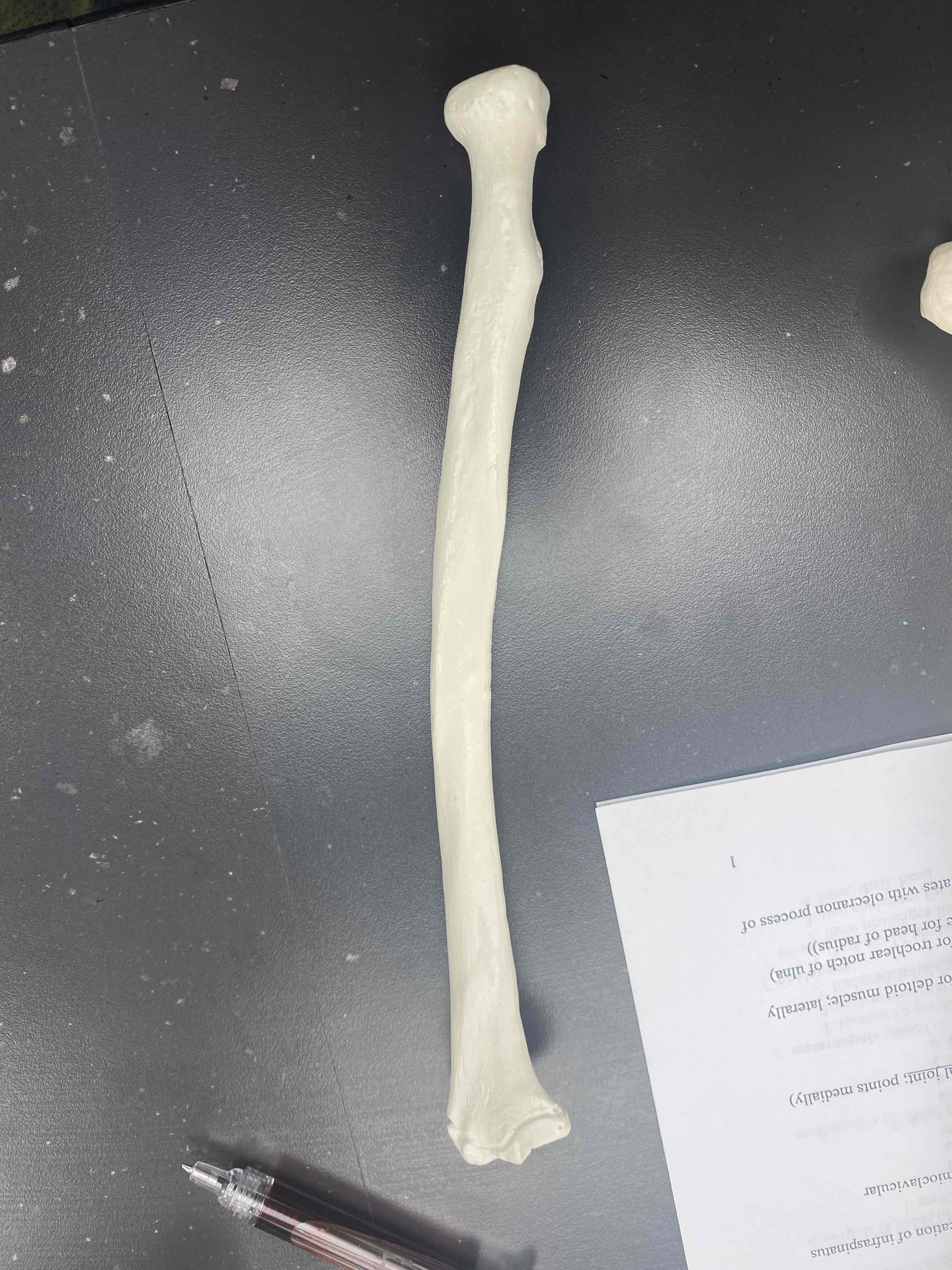 <p>name the bone </p>