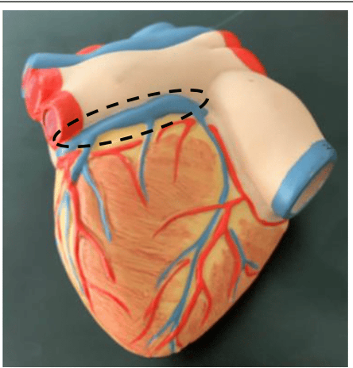 <p>runs with the circumflex branch ; LCA</p>