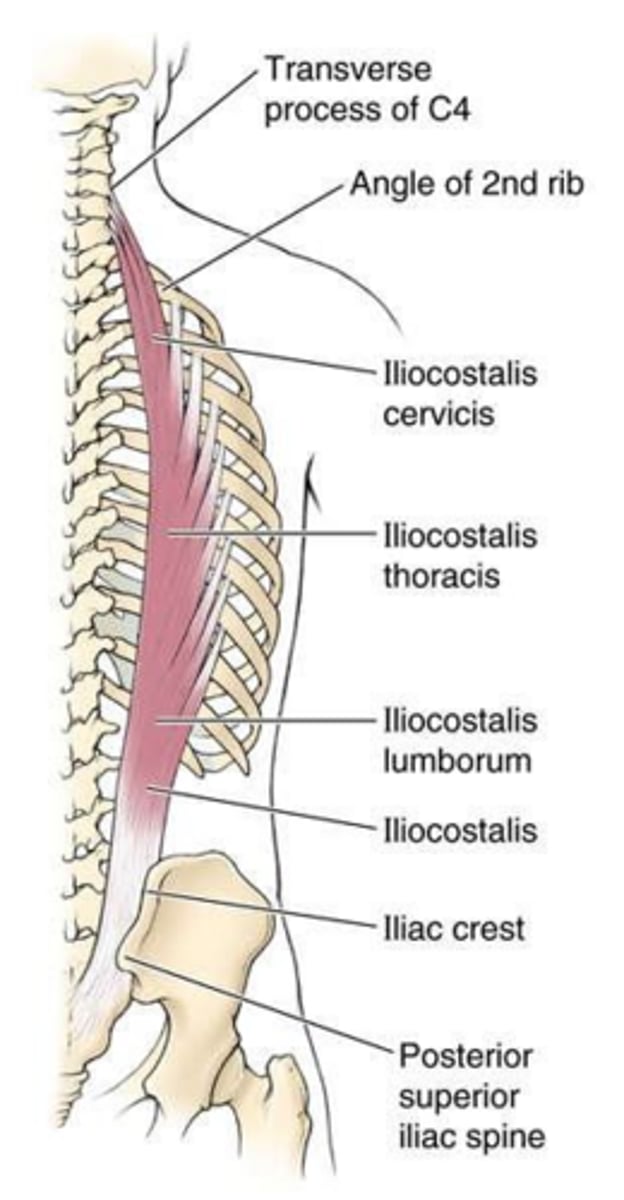 <p>Segmental medullary arteries anastomose with spinal arteries; radicular arteries do not.</p>