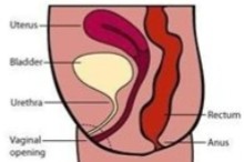 <ol><li><p>Is this image of the pelvis normal or abnormal?</p></li><li><p>If abnormal, what can be assumed here?</p></li></ol><p></p>