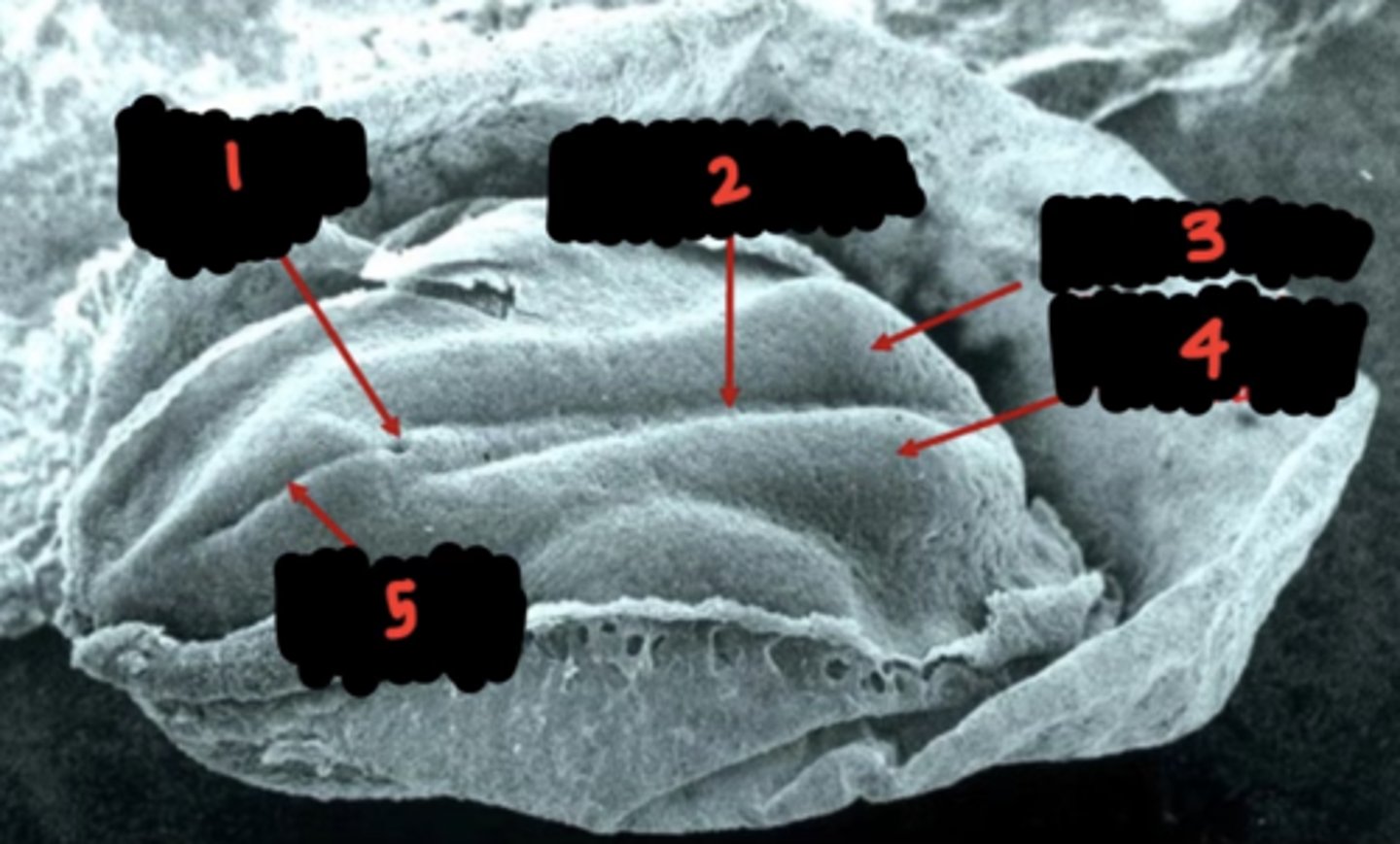 <p>4 <br>neural folds ( ___ )</p>