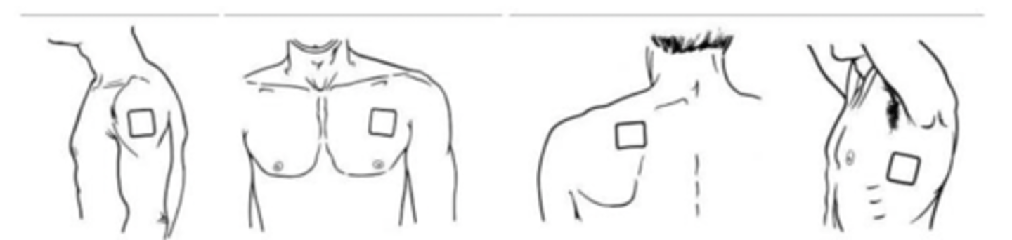 <p>anywhere (chest, back, upper arm) besides the flanks (instead its either side @ chest level)</p>