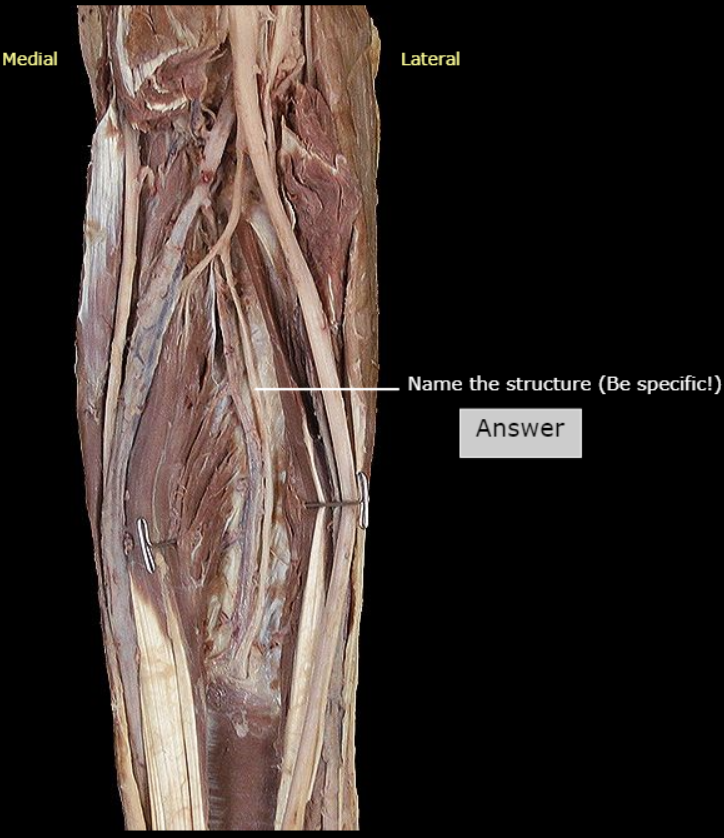 <p>What nerve is this</p>