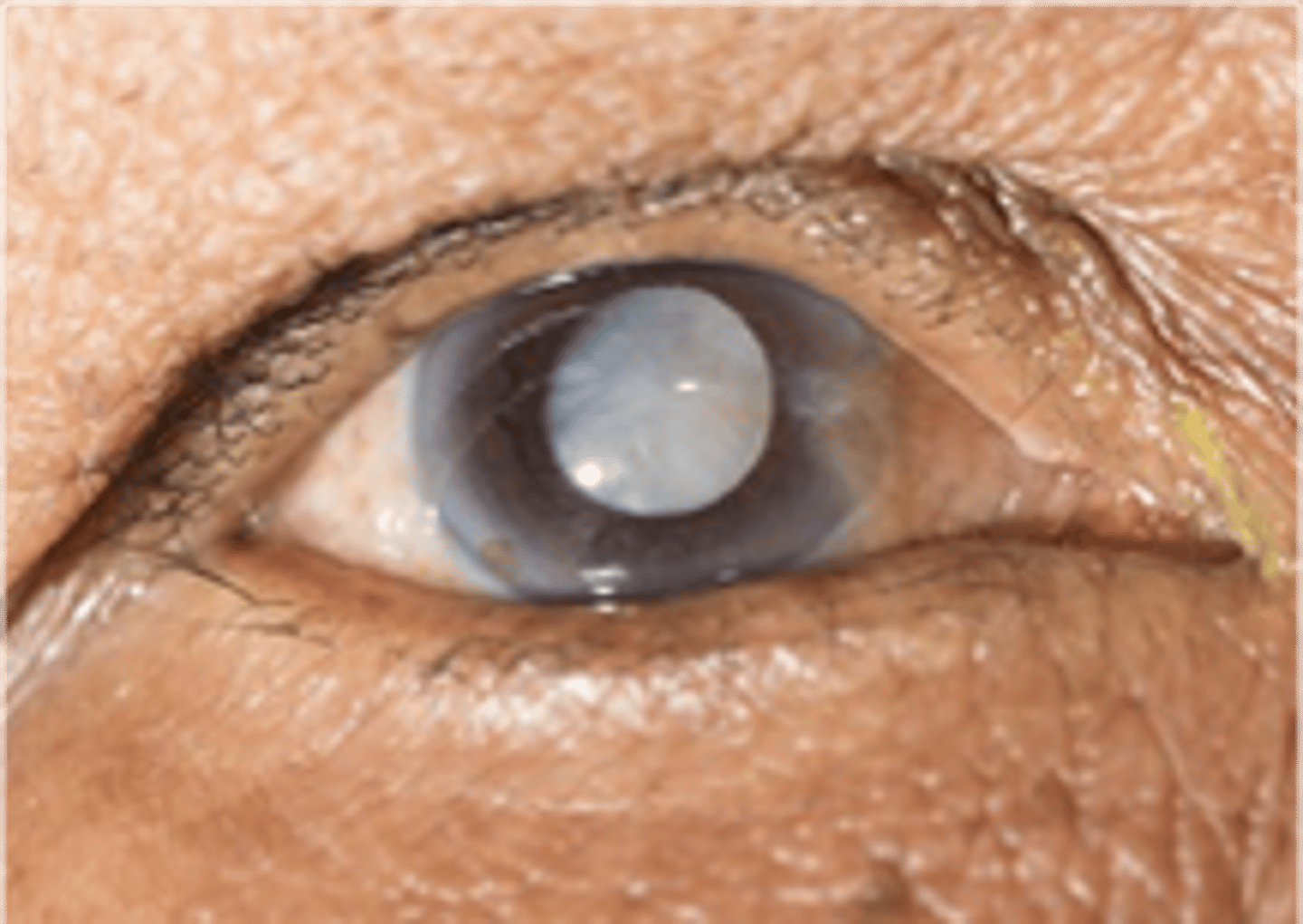 <p>name the abnormality</p>