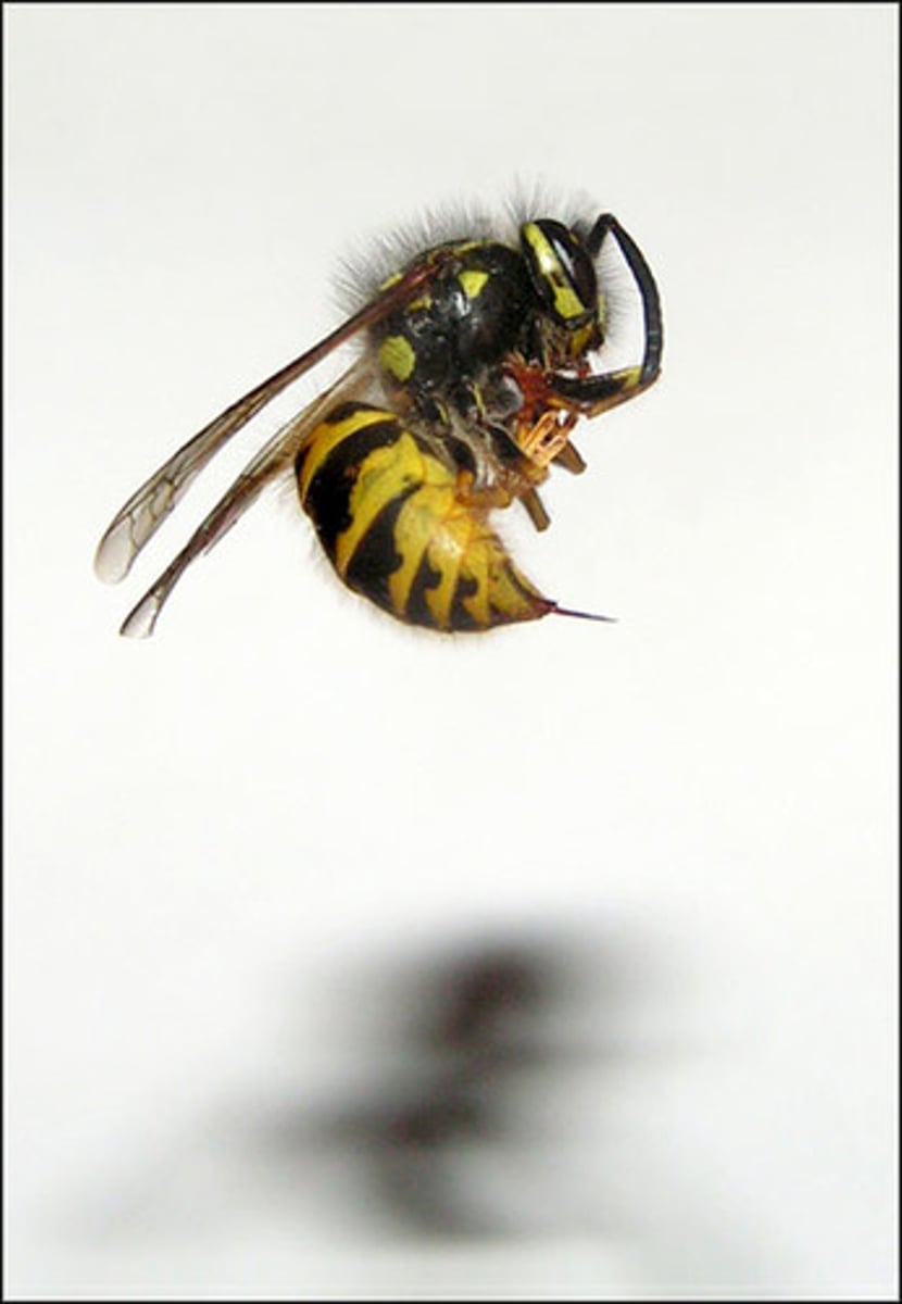 <p>Identify the abdominal structure.</p>