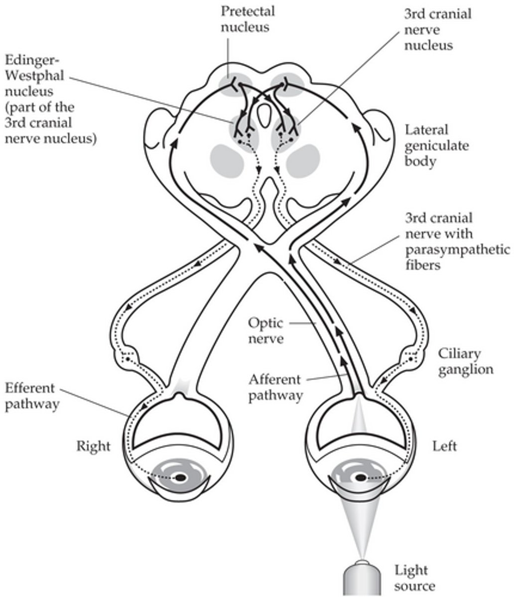 <p>Optic chiasm</p><p>Optic tract</p><p>Bifurcation of pupillomotor fibers in superior colliculus</p><p>Pretectal area</p><p>Bilateral interneurons</p><p>Edinger Westphal nuclei</p>