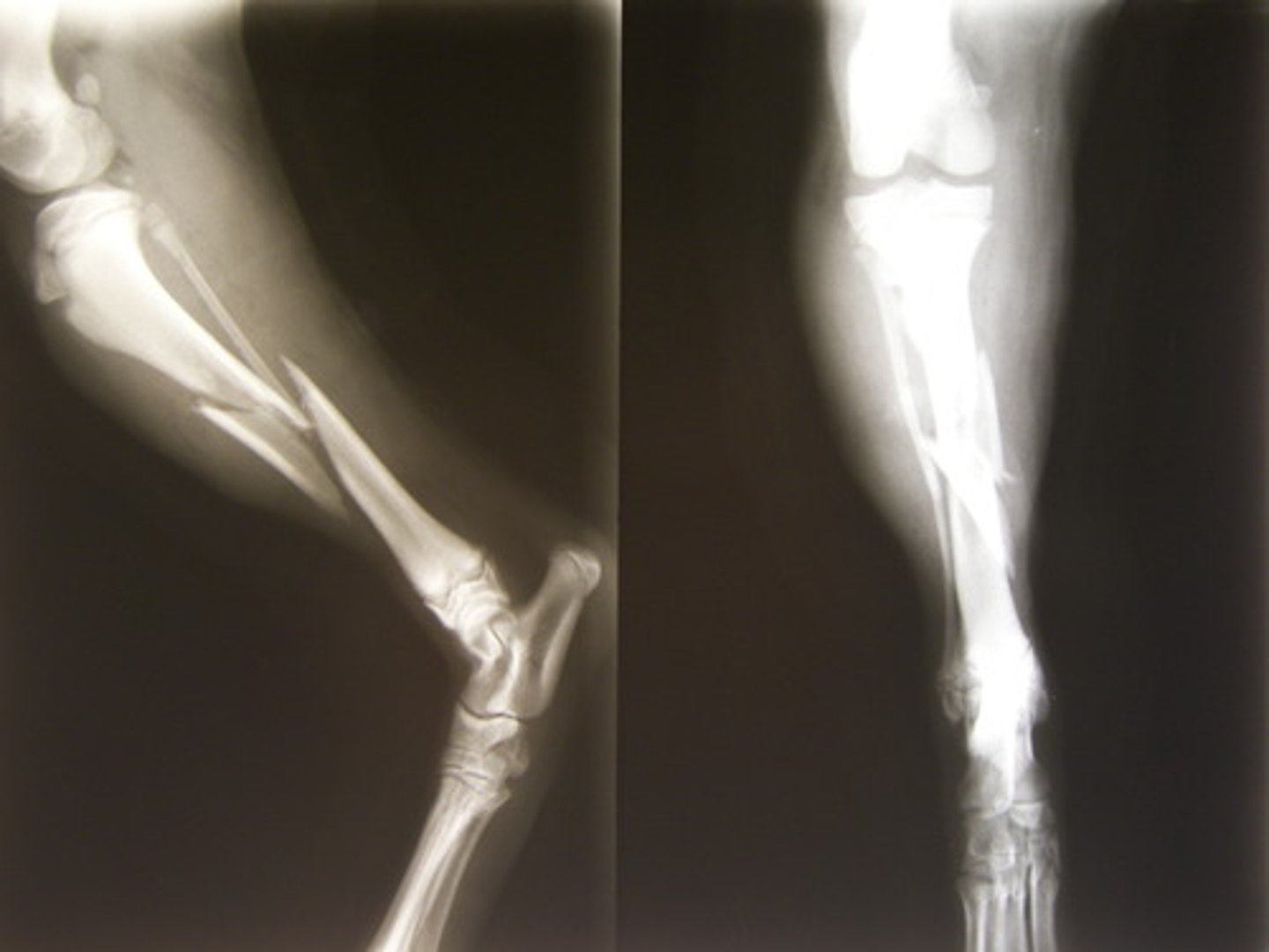 <p>to break one's leg</p>