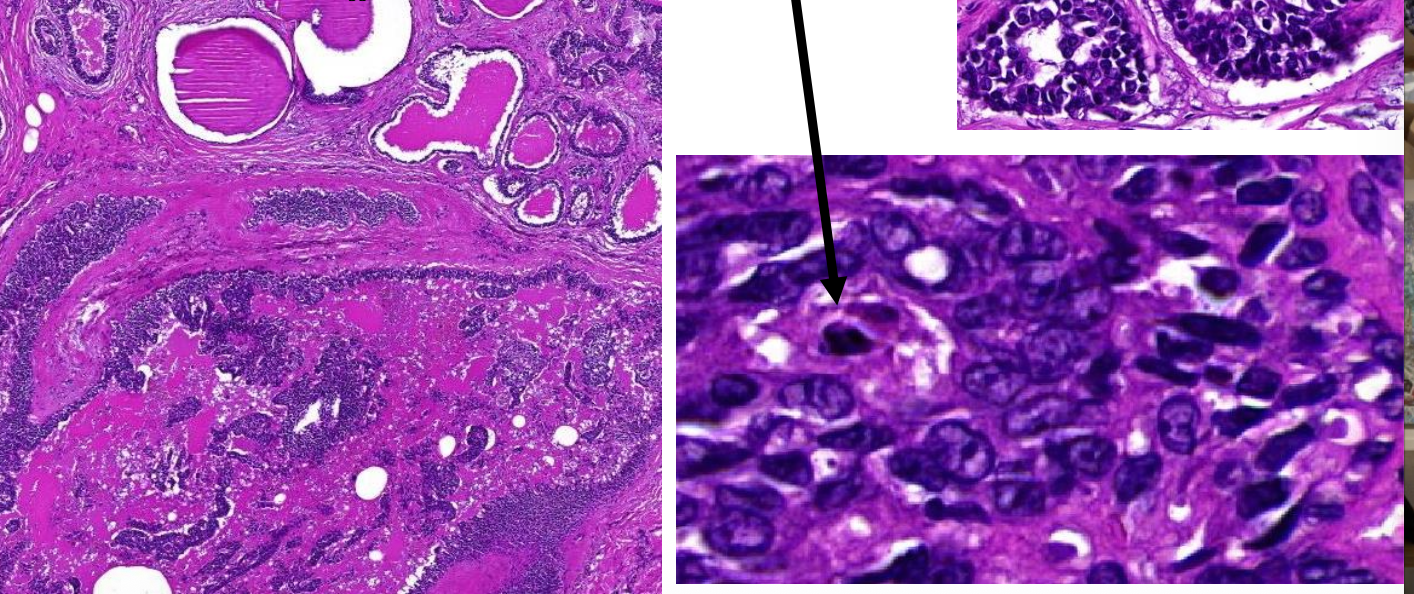 <p>Welk preparaat</p>