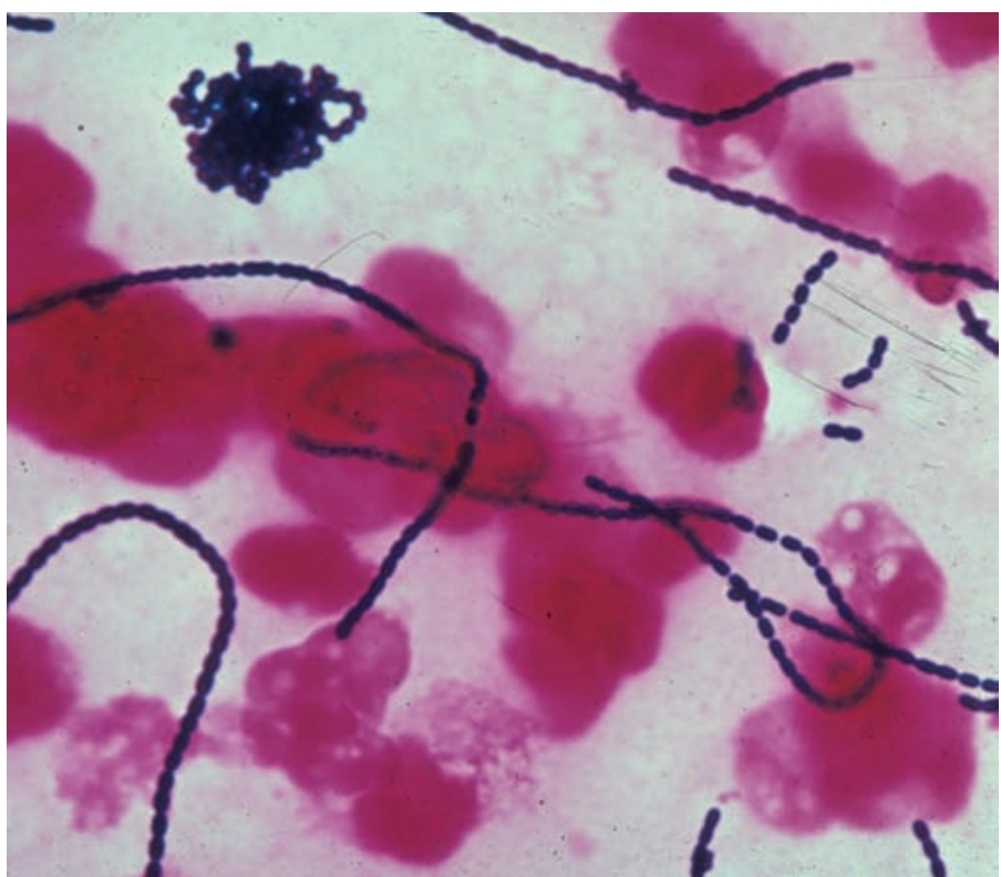 <p>Cocci in chains</p>