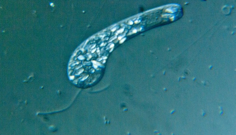 <p>What stain was used in the sample?</p>
