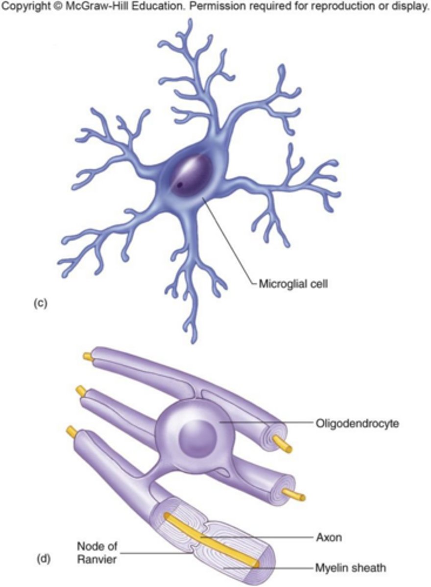 <p>Multiple sclerosis.</p>