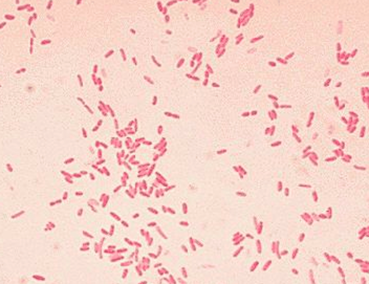 <p>- -ve coccobacillus</p><p>- aerobic</p><p>- causes whooping cough</p><p>- virulence factors: pertussis toxin, tracheal cytotocin</p><p>- grows on Bordet-Gengou or Regan-Lowe agar</p><p>- PCR-based diag</p>