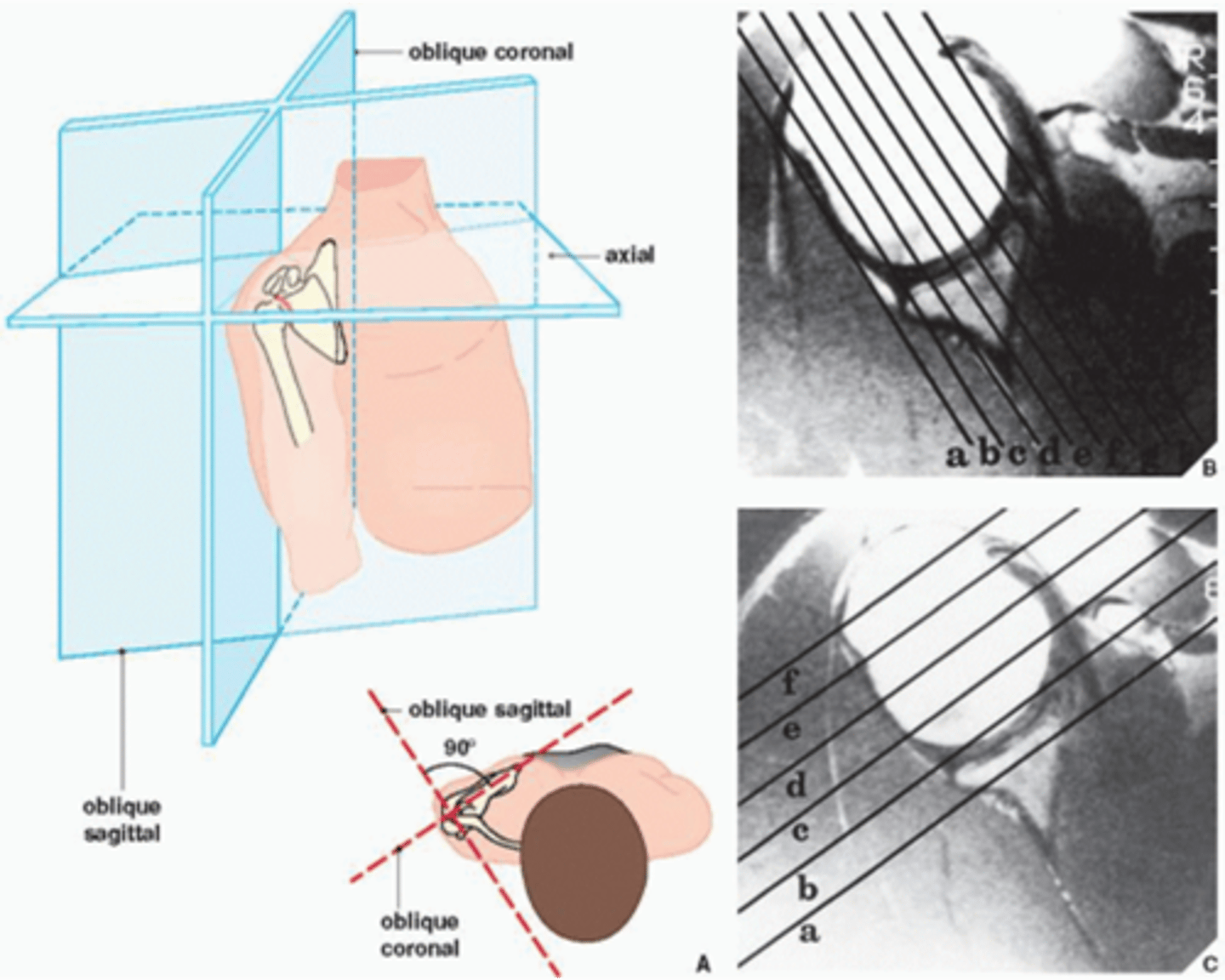 <p>Explain the difference between each of the MRI slices.</p>