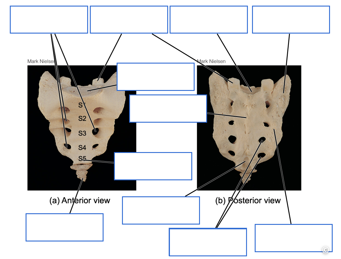 <p>Identify the bone features of the sacrum + coccyx</p>