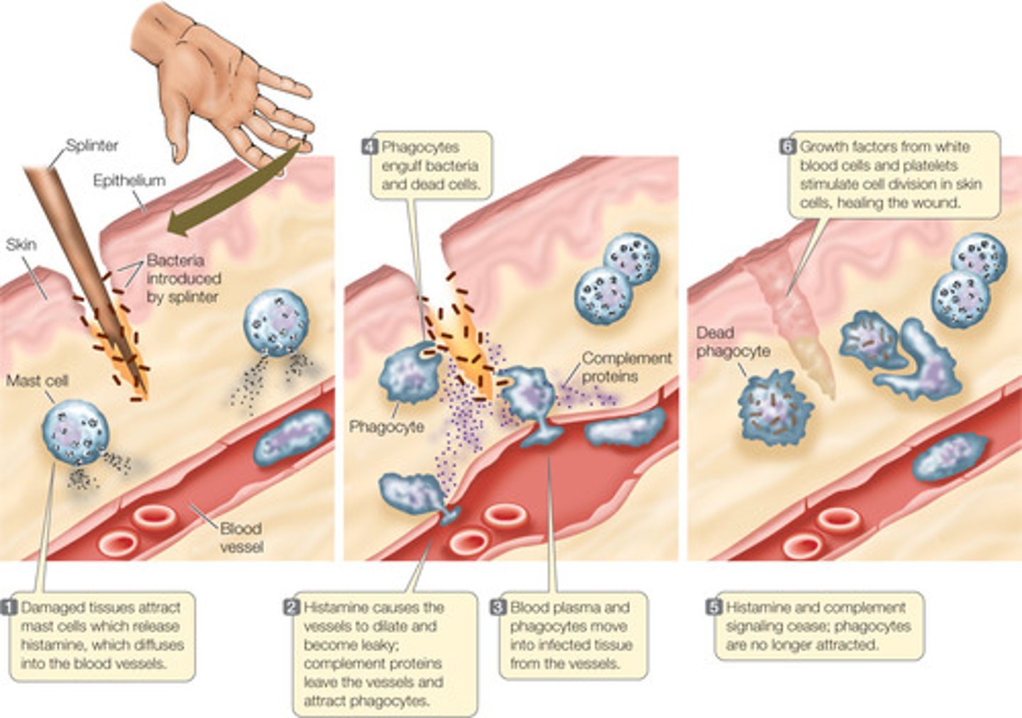 <p>Cells that detect damage in the tissue and release cytokines and histamine</p>