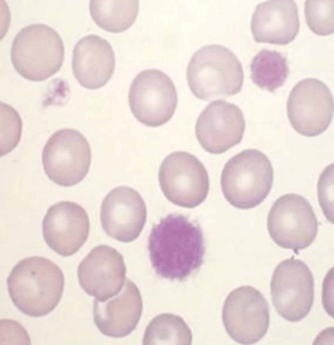 <p>what leukocyte is this?</p>