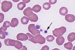 <p><span style="color: rgb(246, 246, 246);"><span><br>causes thrombocytotrophic ehrlichiosis (platelets);</span></span><span style="color: rgb(238, 233, 233);"><span> Fever, anorexia, lethargy, swollen lymph nodes, thrombocytopenia</span></span></p>