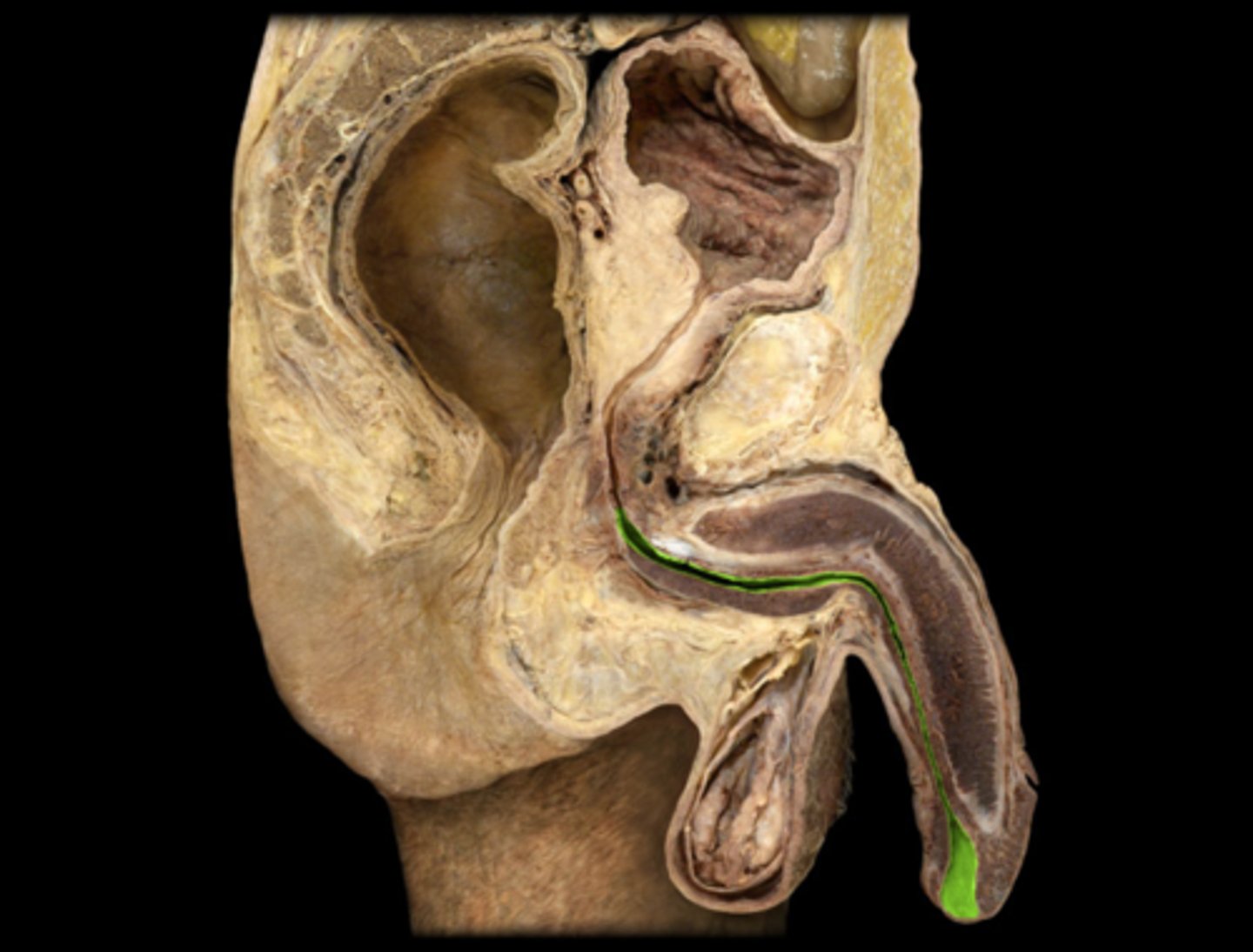 <p>What part of the bladder and urine transport is this?</p>