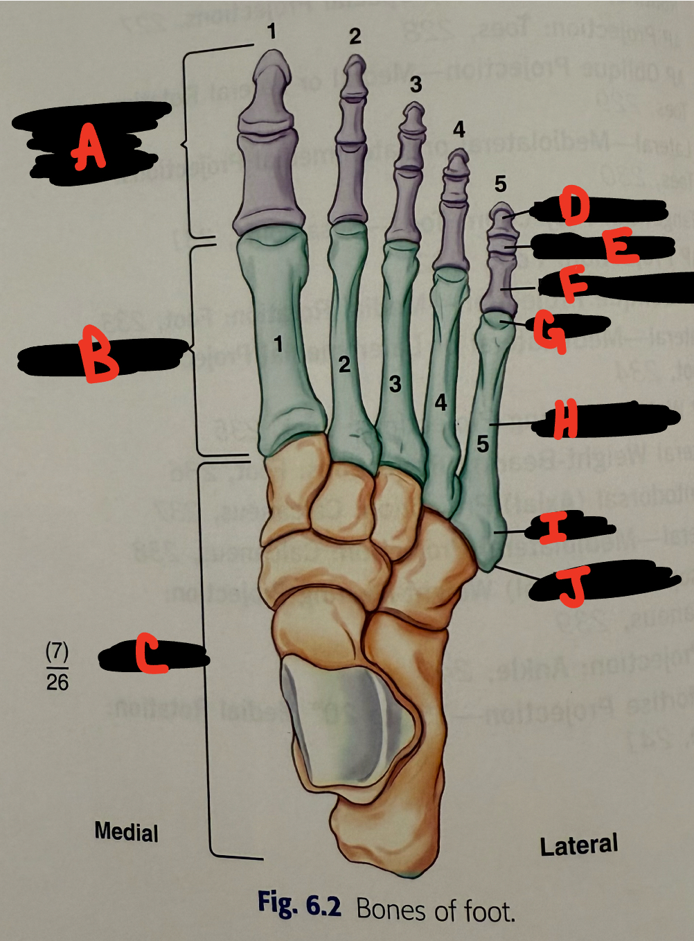 <p>E</p>