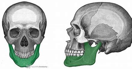 <p>What facial bone is this?</p>