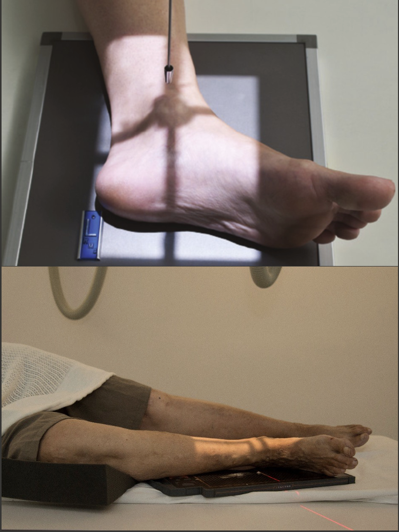<p>Fine FS, 100cm</p><p>60kVp, 4mAs</p><p>Straight tube</p><p>CR: medial malleolus</p>