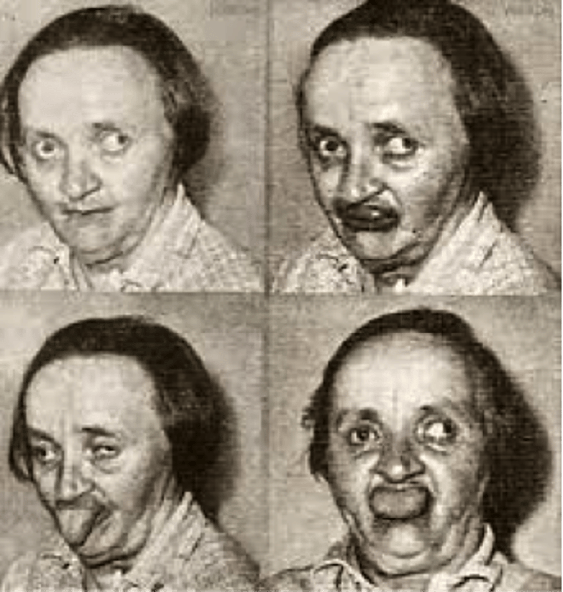 <p>involuntary movements of the facial muscles, tongue, and limbs; a possible neurotoxic side effect of long-term use of antipsychotic drugs that target certain dopamine receptors</p>