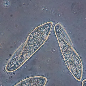 <p>Which protist is this?</p>